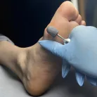 Pedikűrös csiszolósapka 10mm 10db - #120 - Perfect Nails