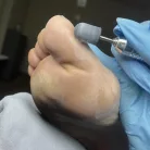 Pedikűrös csiszolósapka 10mm 10db - #180 - Perfect Nails