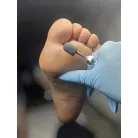 Pedikűrös csiszolósapka 10mm 10db - #180 - Perfect Nails