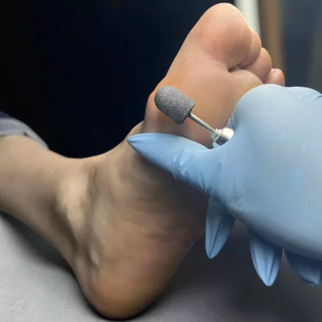 Pedikűrös csiszolósapka 16mm 10db - #180 - Perfect Nails