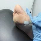 Pedikűrös csiszolósapka 16mm 10db - #180 - Perfect Nails