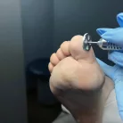 Pedikűrös Csiszolókorong tartó - 25mm - Perfect Nails