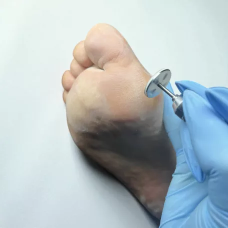 Pedikűrös Csiszolókorong 25mm 50db - #120 - Perfect Nails